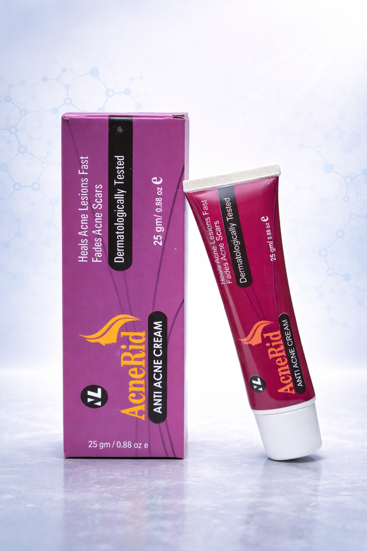 AcneRid anti-acne cream tube and packaging on a light blue gradient background